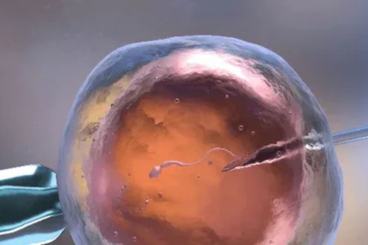Awesome Image