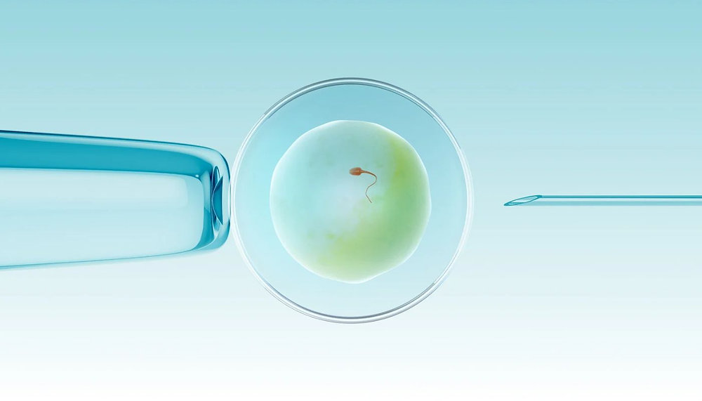 Surgical Sperm Aspiration