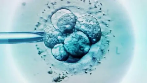 Frozen Embryo Transfer